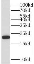 TMEM199 antibody|TMEM199抗体