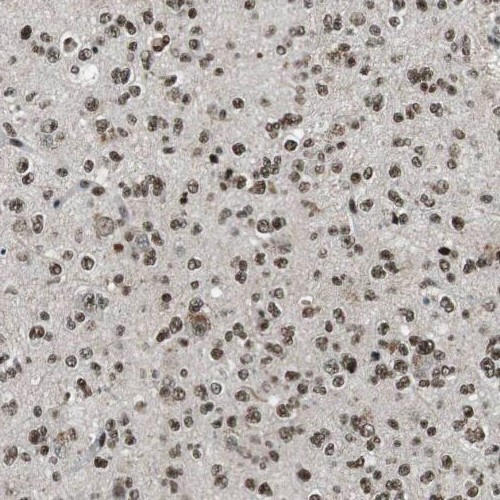 RMI1 antibody|RMI1抗体