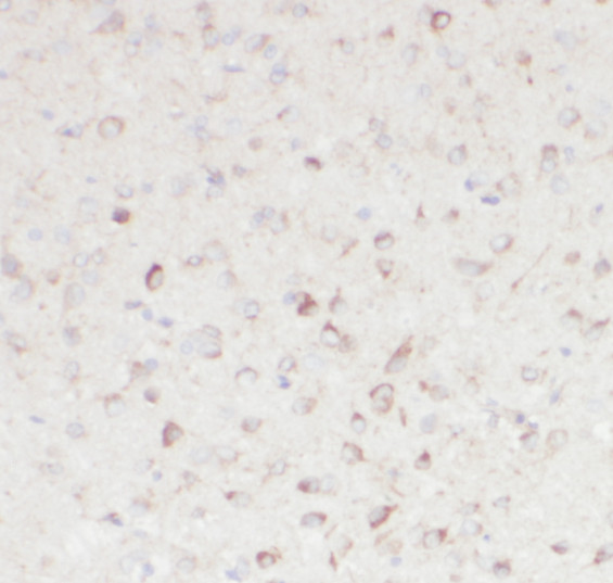 RNF10 antibody|RNF10抗体