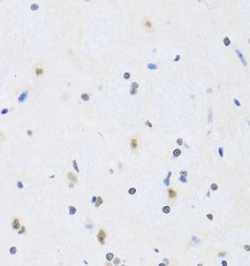 PRPF19 antibody|PRPF19抗体