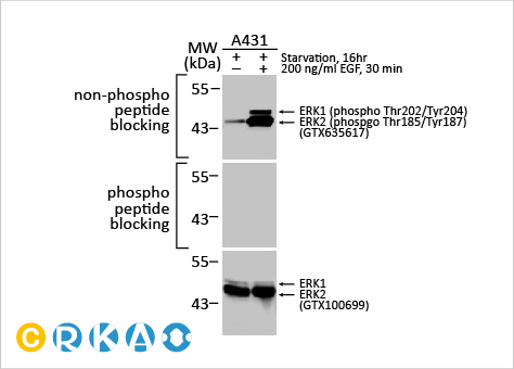 文献速递：细胞外基质硬化与睾丸老化及睾酮水平下降相关
