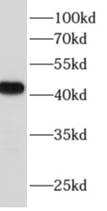 ACTC1 antibody|ACTC1抗体 FNab003