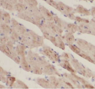 VDAC1 antibody|VDAC1抗体 FNab093