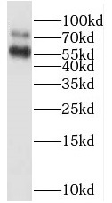 RAPGEFL1 antibody|RAPGEFL1抗体