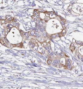TWF1 antibody|TWF1抗体