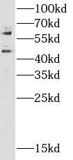 CAMK2A antibody|CAMK2A抗体