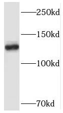 SMC5 antibody|SMC5抗体