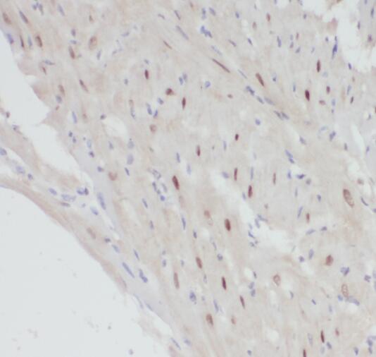 POLR2J antibody|POLR2J抗体