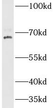 CLPX antibody|CLPX抗体
