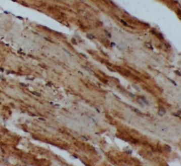 ACOT2 antibody|ACOT2抗体