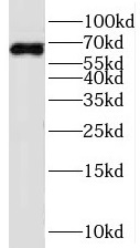 SERINC1 antibody|SERINC1抗体