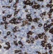 STX11 antibody|STX11抗体