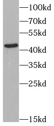 CCR7 antibody|CCR7抗体