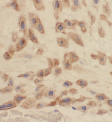 CA13 antibody|CA13抗体