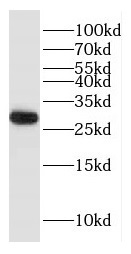 HDHD3 antibody|HDHD3抗体