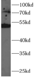 HAS3 antibody|HAS3抗体 FNab10036