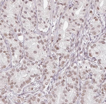BRD3 antibody|BRD3抗体