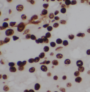 MUTYH antibody|MUTYH抗体 FNab054