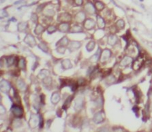 ERBB2 antibody|ERBB2抗体 FNab038