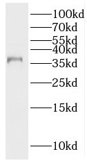PNMA1 antibody|PNMA1抗体