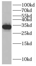 SLC25A34 antibody|SLC25A34抗体