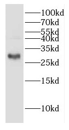 DHRS3 antibody|DHRS3抗体