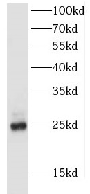 FEV antibody|FEV抗体