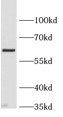 SLC2A9 antibody|SLC2A9抗体