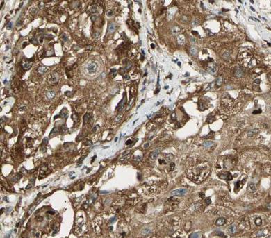 ARSA antibody|ARSA抗体