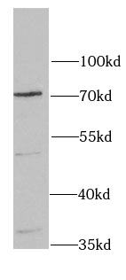 HAS3 antibody|HAS3抗体 FNab03760