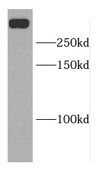 DIDO1 antibody|DIDO1抗体 FNab023