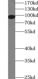 ALDH1L1 antibody|ALDH1L1抗体