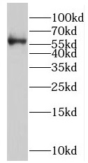 RORC antibody|RORC抗体 FNab07389