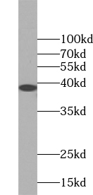 TSPAN5 antibody|TSPAN5抗体