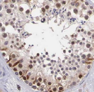 ARID4B antibody|ARID4B抗体