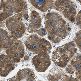 DGUOK antibody|DGUOK抗体 FNab023