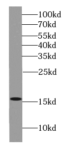 H2AC25 antibody|H2AC25抗体