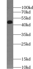 CKB-Specific antibody|CKB抗体
