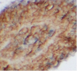 ELK1 antibody|ELK1抗体 FNab10070