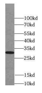 SEPTIN4 antibody|SEPTIN4抗体