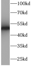 CD2 antibody|CD2抗体 FNab01437