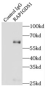 PRKCSH antibody|PRKCSH抗体