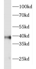 FOXR2 antibody|FOXR2抗体