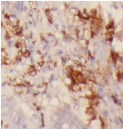 ST6GAL1 antibody|ST6GAL1抗体 FNa