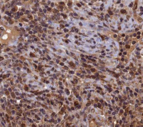 APEX1 antibody|APEX1抗体 FNab004