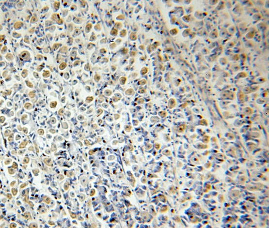 RELA antibody|RELA抗体 FNab06089