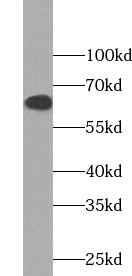 PTGS2 antibody|PTGS2抗体 FNab018