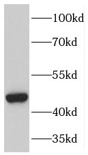 MAPK8 antibody|MAPK8抗体 FNab044