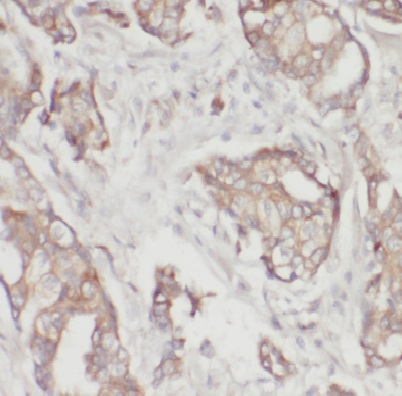 E2F1 antibody|E2F1抗体