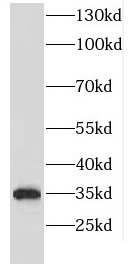 EMD antibody|EMD抗体